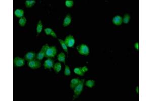 Immunofluorescence staining of SH-SY5Y cells with ABIN7166416 at 1:100, counter-stained with DAPI. (TGM4 antibody  (AA 1-684))