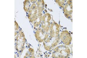 Immunohistochemistry of paraffin-embedded human gastric using CAMK2G antibody at dilution of 1:100 (x40 lens).