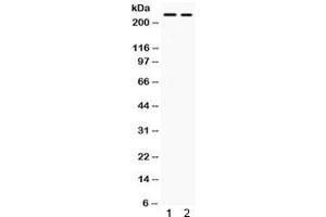 Western blot testing of human 1) SW620 and 2) HepG2 lysate with ARID1A antibody. (ARID1A antibody)