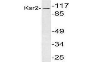 Western blot analysis of KSR2 in extracts from 293 cells using Kinase suppressor of Ras 2 antibody .