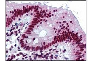 Immunohistochemistry (IHC) image for anti-Heterogeneous Nuclear Ribonucleoprotein K (HNRNPK) (C-Term) antibody (ABIN264512) (HNRNPK antibody  (C-Term))