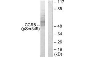 Western blot analysis of extracts from RAW264. (CCR5 antibody  (pSer349))