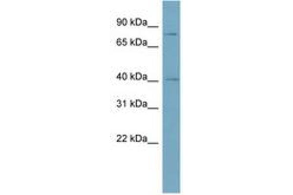 SPPL2C antibody  (AA 575-624)