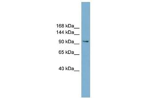 NCAM2 antibody used at 1 ug/ml to detect target protein. (NCAM2 antibody  (Middle Region))