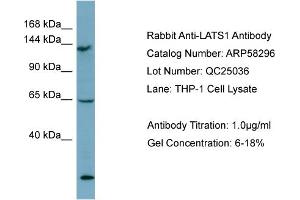 WB Suggested Anti-LATS1  Antibody Titration: 0. (LATS1 antibody  (Middle Region))