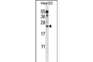 Western blot analysis in HepG2 cell line lysates (35ug/lane). (ANKRD22 antibody  (C-Term))