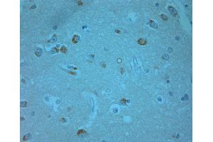 human olfactory-1 (ERK1/2 antibody  (pThr202, pTyr204))