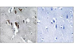 Immunohistochemistry analysis of paraffin-embedded human brain tissue using ELOVL5 antibody. (ELOVL5 antibody  (C-Term))