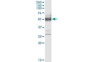 Immunoprecipitation of PLA2G15 transfected lysate using anti-PLA2G15 MaxPab rabbit polyclonal antibody and Protein A Magnetic Bead , and immunoblotted with PLA2G15 purified MaxPab mouse polyclonal antibody (B01P) . (PLA2G15 antibody  (AA 1-412))