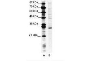 Image no. 1 for anti-Ring Finger Protein 141 (RNF141) (AA 96-145) antibody (ABIN202098) (RNF141 antibody  (AA 96-145))