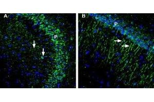 Expression of GIPC1 in mouse and rat hippocampusImmunohistochemical staining of perfusion-fixed frozen mouse and rat brain sections with Anti-GIPC1 Antibody (ABIN7043215, ABIN7045188 and ABIN7045189), (1:200), followed by goat-anti-rabbit-AlexaFluor-488. (GIPC PDZ Domain Containing Family, Member 1 (GIPC1) Peptide)