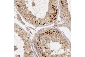 Immunohistochemical staining of human testis with CTCFL polyclonal antibody  shows strong nuclear positivity in primary spermatocytes.