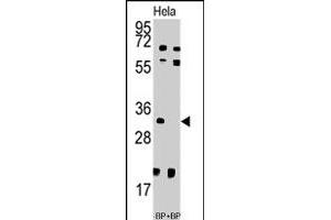 Western blot analysis of UCK2 polyclonal antibody  pre-incubated with and without blocking peptide (BP7192a) in HeLa cell line lysate. (UCK2 antibody  (N-Term))