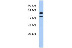 Cyclin B1 antibody used at 1 ug/ml to detect target protein. (Cyclin B1 antibody  (Middle Region))