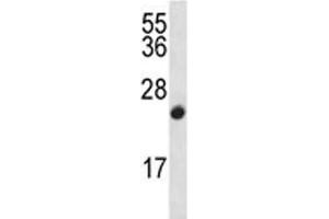 CDKN2B antibody western blot analysis in CEM lysate