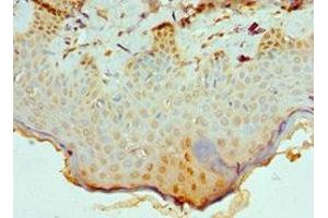 Immunohistochemistry of paraffin-embedded human skin tissue using ABIN7147709 at dilution of 1:100 (CBX8 antibody  (AA 80-280))