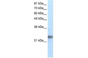 Transfected 293T; WB Suggested Anti-ZNF313 Antibody Titration: 1. (RNF114 antibody  (N-Term))