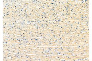 ABIN6265899 and ABIN6273182 at 1/100 staining Rat heart tissue by IHC-P. (UQCRC1 antibody  (C-Term))