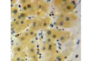 #VALUE! (HSPB2 antibody  (AA 12-170))