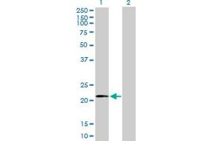 Western Blot analysis of MRPL11 expression in transfected 293T cell line by MRPL11 MaxPab polyclonal antibody. (MRPL11 antibody  (AA 1-192))
