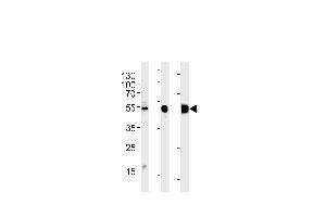Western blot analysis in RD cell line and mouse skeletal muscle,rat skeletal muscle lysates (35ug/lane). (ENO3 antibody  (AA 237-264))