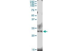 Immunoprecipitation of NUDT4 transfected lysate using anti-NUDT4 MaxPab rabbit polyclonal antibody and Protein A Magnetic Bead , and immunoblotted with NUDT4 purified MaxPab mouse polyclonal antibody (B01P) . (NUDT4 antibody  (AA 1-180))