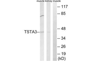 Western blot analysis of extracts from rat kidney cells and rat muscle cells, using TSTA3 antibody. (TSTA3 antibody  (C-Term))