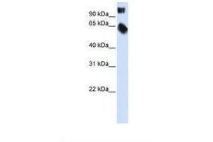 Image no. 1 for anti-TSC22 Domain Family, Member 2 (TSC22D2) (AA 614-663) antibody (ABIN6737731) (TSC22D2 antibody  (AA 614-663))