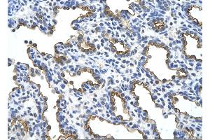 Rabbit Anti-MUC1 Antibody       Paraffin Embedded Tissue:  Human alveolar cell   Cellular Data:  Epithelial cells of renal tubule  Antibody Concentration:   4. (MUC1 antibody  (C-Term))