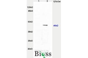 L1 rat brain, L2 human colon carcinoma lysates probed  at 1:3000 90min in 37˚C. (TWIST1, TWIST2 (AA 71-170) antibody)