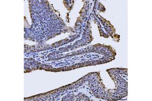 IHC analysis of FIP1L1 using anti-FIP1L1 antibody (ABIN7600761). (FIP1L1 antibody  (AA 23-558))