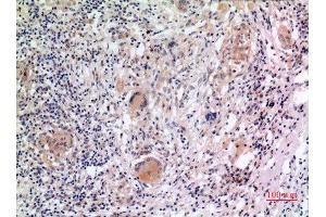 Immunohistochemistry (IHC) analysis of paraffin-embedded Human Lung, antibody was diluted at 1:100. (NLRP3 antibody  (Internal Region))