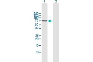 Western Blot analysis of PIAS2 expression in transfected 293T cell line by PIAS2 MaxPab polyclonal antibody. (PIAS2 antibody  (AA 1-572))