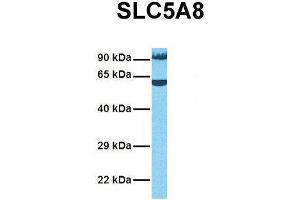 Host:  Rabbit  Target Name:  SLC5A8  Sample Tissue:  Human OVCAR-3  Antibody Dilution:  1. (SLC5A8 antibody  (Middle Region))