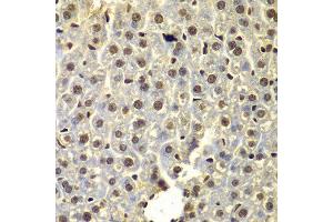 Immunohistochemistry of paraffin-embedded mouse liver using SSX5 antibody at dilution of 1:100 (x400 lens). (SSX5 antibody)