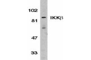 Western blot analysis of IKK beta in Jurkat whole cell lysate with AP30406PU-N IKK beta antibody (C3) at 1/500 dilution. (IKBKB antibody  (C-Term))