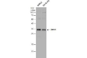 WB Image SNAI1 antibody detects SNAI1 protein by western blot analysis. (SNAIL antibody)