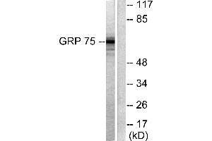 Western blot analysis of extracts from COS7 cells, using GRP75 antibody (#C0216). (HSPA9 antibody)