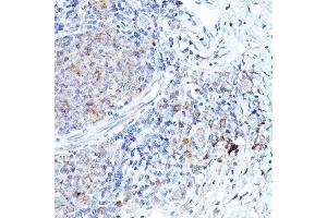 Immunohistochemistry of paraffin-embedded rat lung using BOK Rabbit pAb (ABIN7265866) at dilution of 1:100 (40x lens).