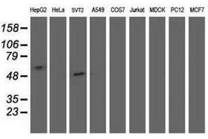 Image no. 2 for anti-Sedoheptulokinase (SHPK) antibody (ABIN1500923) (SHPK antibody)
