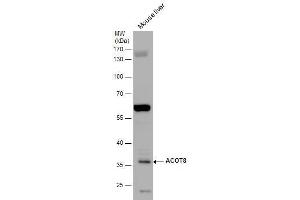 WB Image ACOT8 antibody detects ACOT8 protein by western blot analysis. (ACOT8 antibody)