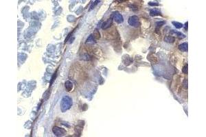 Immunohistochemistry of ICAD in mouse lung tissue with ICAD antibody at 2 μg/ml. (DFFA antibody  (N-Term))