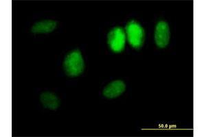 Immunofluorescence of purified MaxPab antibody to DDX11 on HeLa cell. (DDX11 antibody  (AA 1-970))