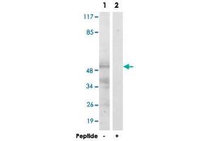 Western blot analysis of extracts from HepG2 cells, using MAPK9/MAPK8 polyclonal antibody . (JNK2 antibody)