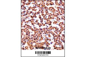 CYP2D6 Antibody immunohistochemistry analysis in formalin fixed and paraffin embedded human liver tissue followed by peroxidase conjugation of the secondary antibody and DAB staining. (CYP2D6 antibody  (N-Term))