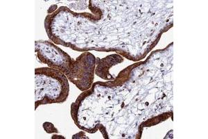 Immunohistochemical staining of human placenta with SPNS1 polyclonal antibody  shows strong cytoplasmic positivity in trophoblastic cells. (SPNS1/Spinster 1 antibody)