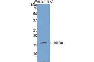 Western blot analysis of the recombinant protein. (Gastrokine 1 antibody  (AA 27-151))