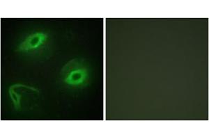 Immunofluorescence analysis of HeLa cells, using LATH antibody. (LATH antibody  (Internal Region))