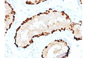 Formalin-fixed, paraffin-embedded human Testis stained with MAGEA4 Mouse Monoclonal Antibody (CPTC-MAGEA4-1). (MAGEA4 antibody)