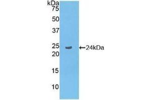 Detection of Recombinant LAT2, Human using Polyclonal Antibody to Linker For Activation Of T-Cells Family, Member 2 (LAT2) (LAT2 antibody  (AA 30-209))